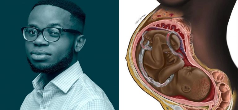 Medical Student Creating Innovative Black Medical Illustrations